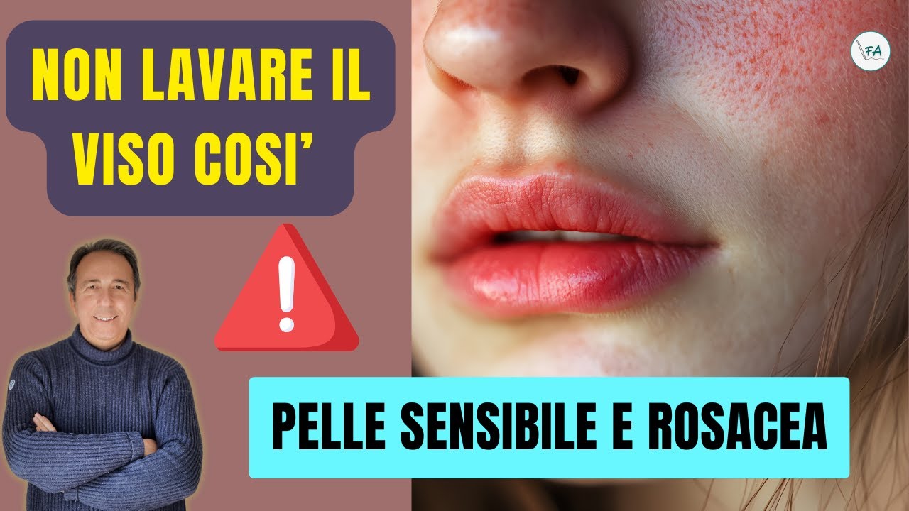 PELLE SENSIBILE E ROSACEA: COME LAVARE IL VISO