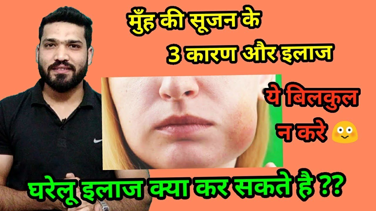 मुँह की सूजन के 3 कारण, घरेलू और क्लीनिकल इलाज । 3 Causes of mouth swelling & treatment