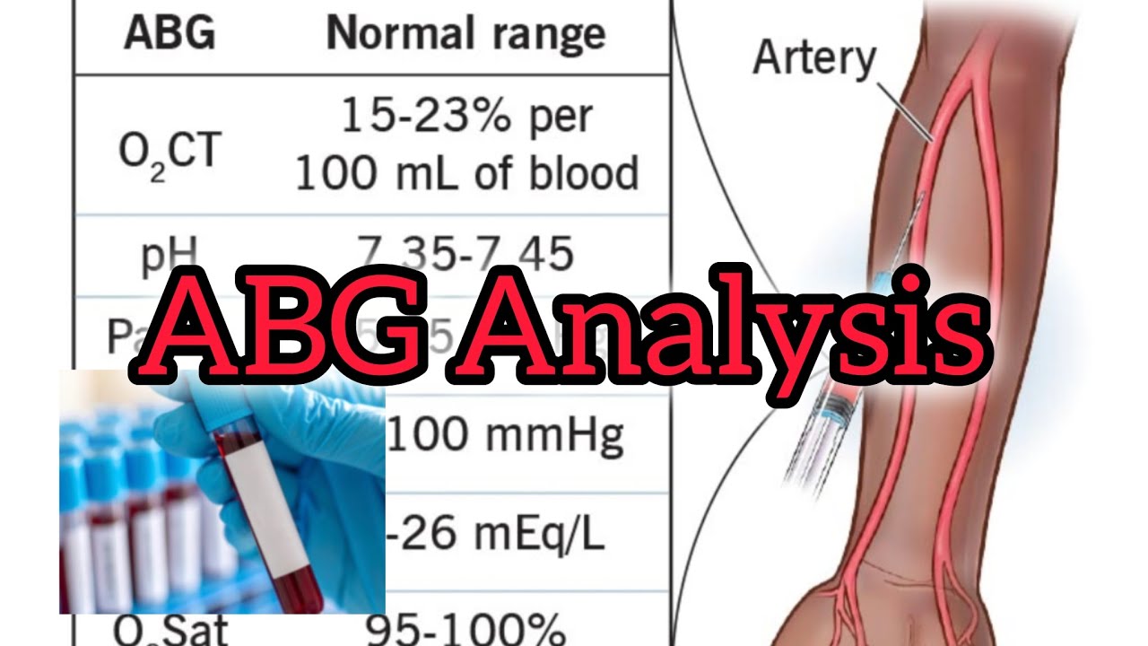 Abg analysis 