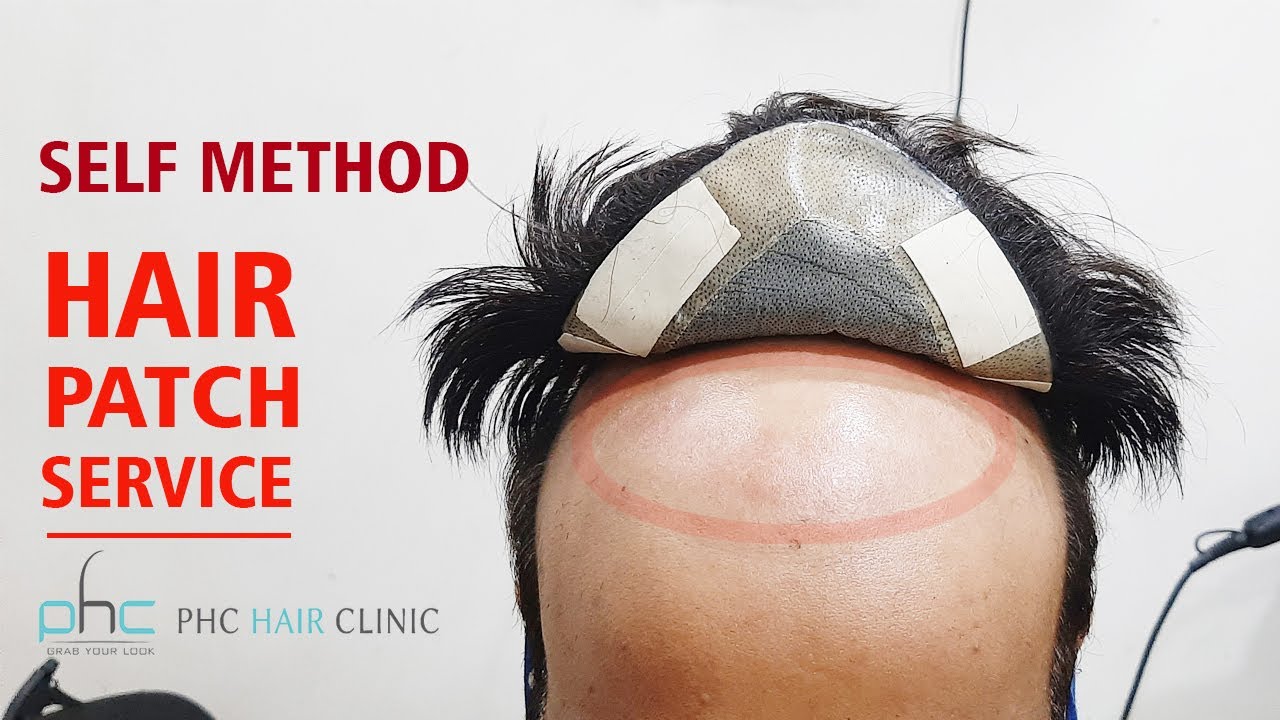 Self Service / Training at home of Hair Patch in Delhi by Planet of Hair Cloning Call 9899746489