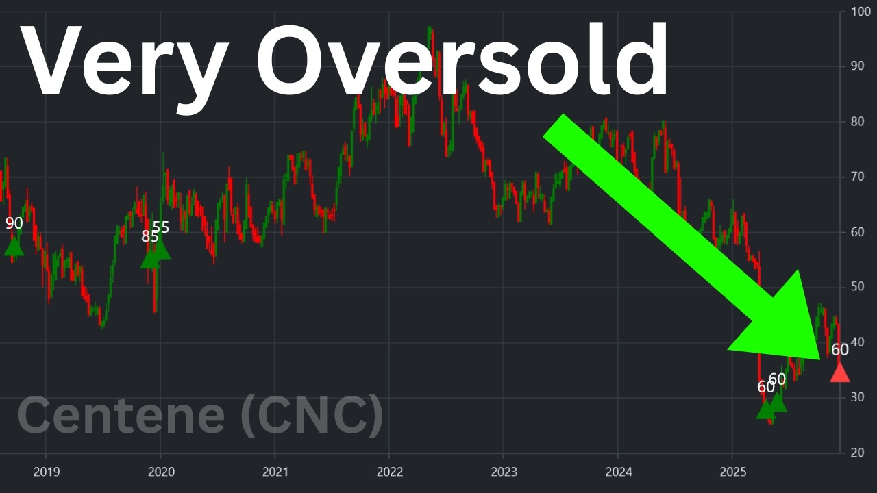4 Extremely Oversold Stocks: Centene, Carnival...
