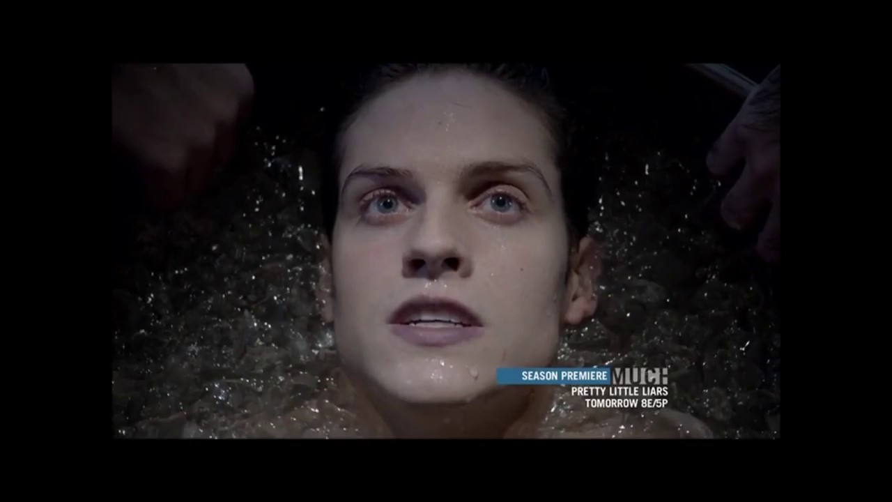 Teen Wolf | Волчонок | Музыкальная нарезка
