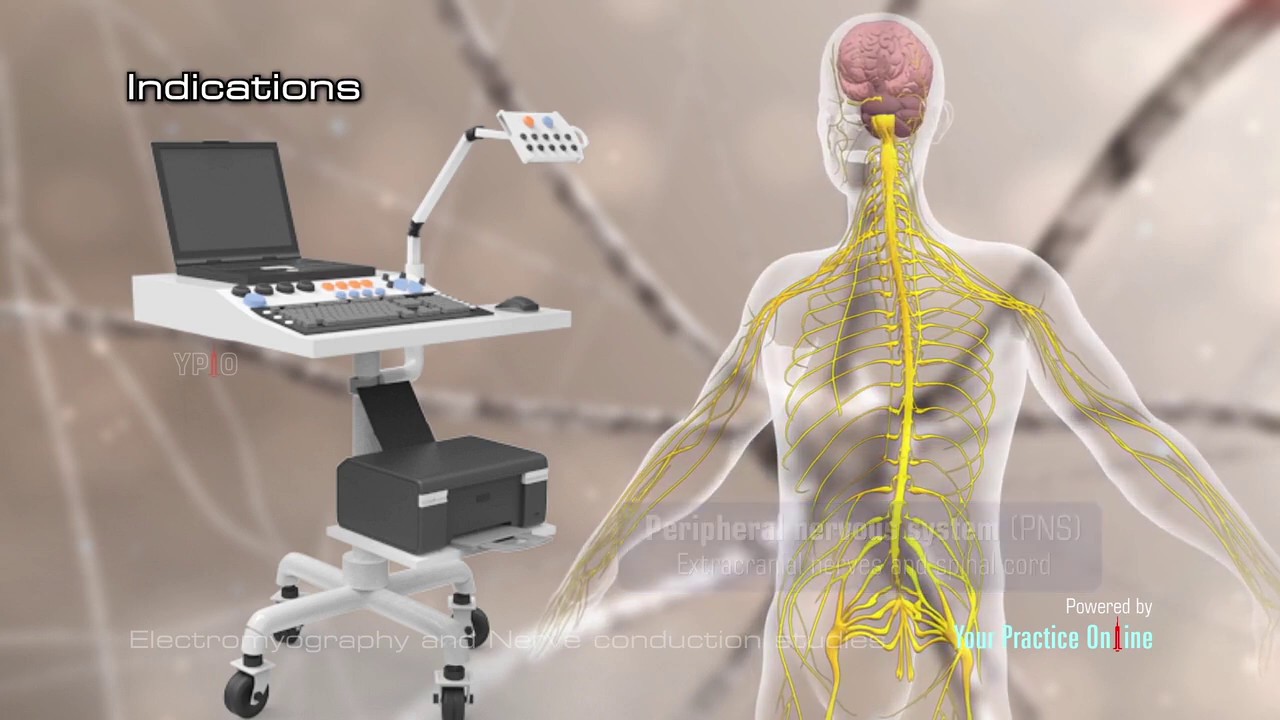 Electromyography and Nerve Conduction Studies
