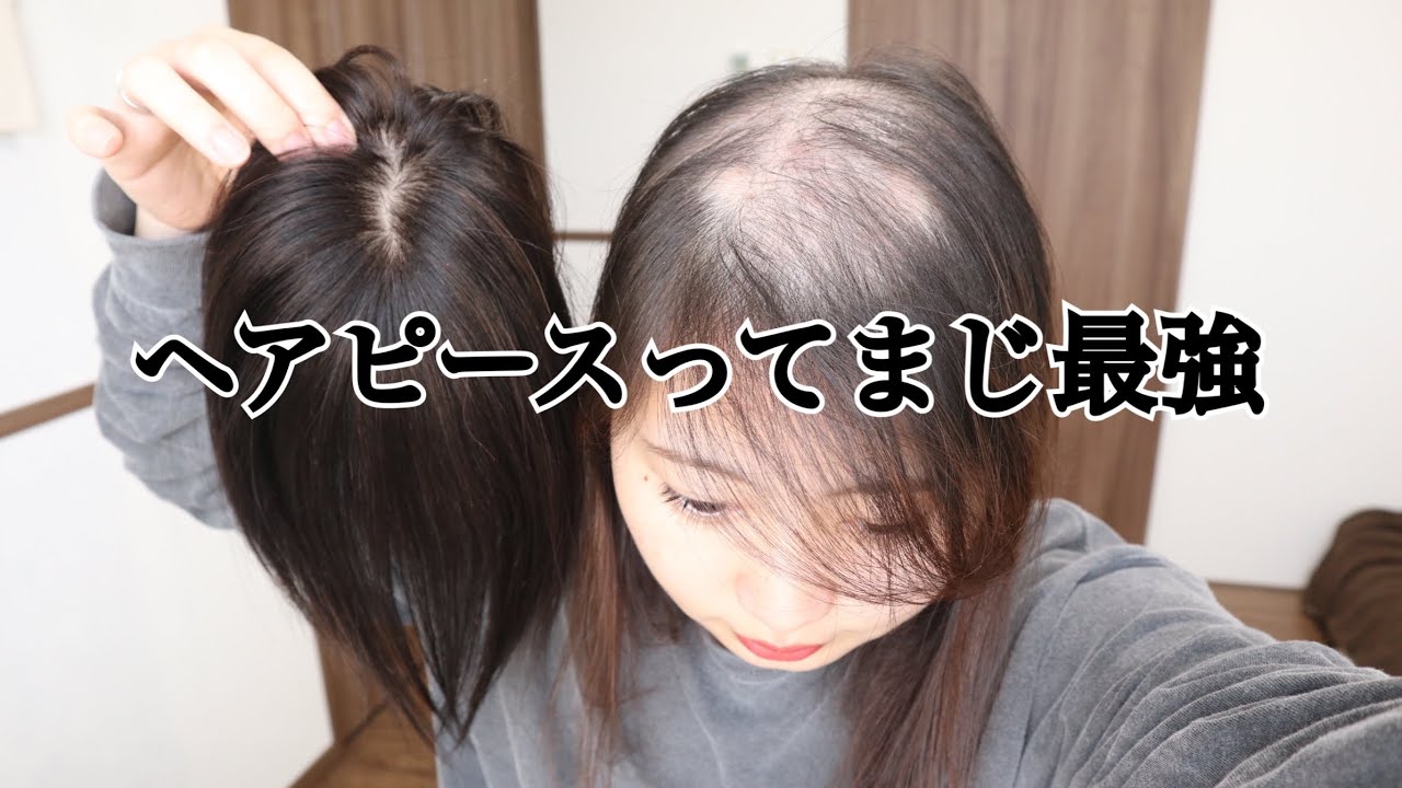 【脱毛症】14,800円の人毛100%ヘアピース紹介！