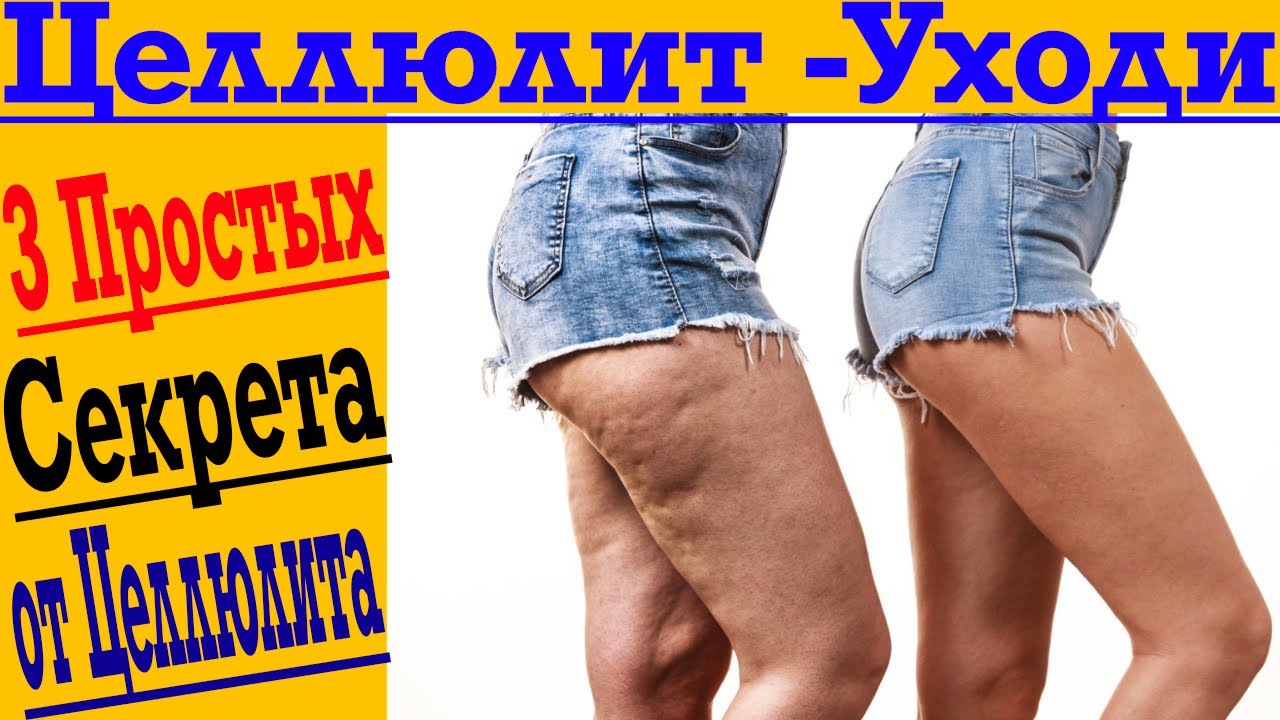 Как избавиться от целлюлита навсегда! Три простые секрета красоты!