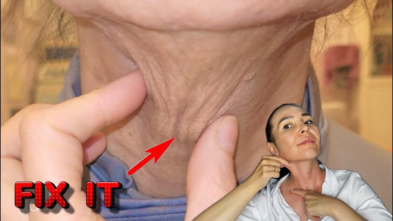How I improved my SAGGING NECK | THE BEST from MASSAGE and FACE YOGA 🔥| Do it with me