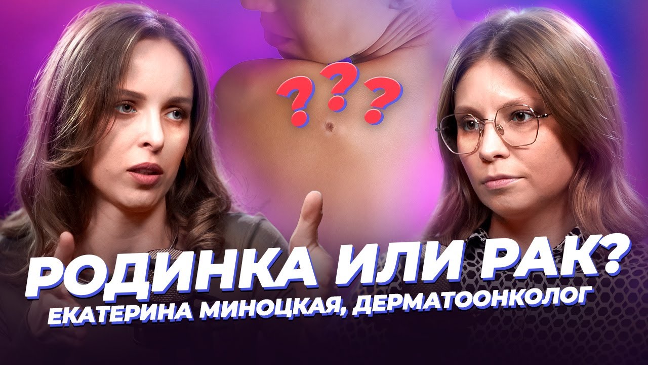 Родинка или рак: как отличить 🎙 Екатерина Миноцкая, дерматоонколог