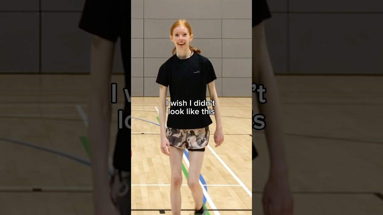 the transformation is insane…🤯