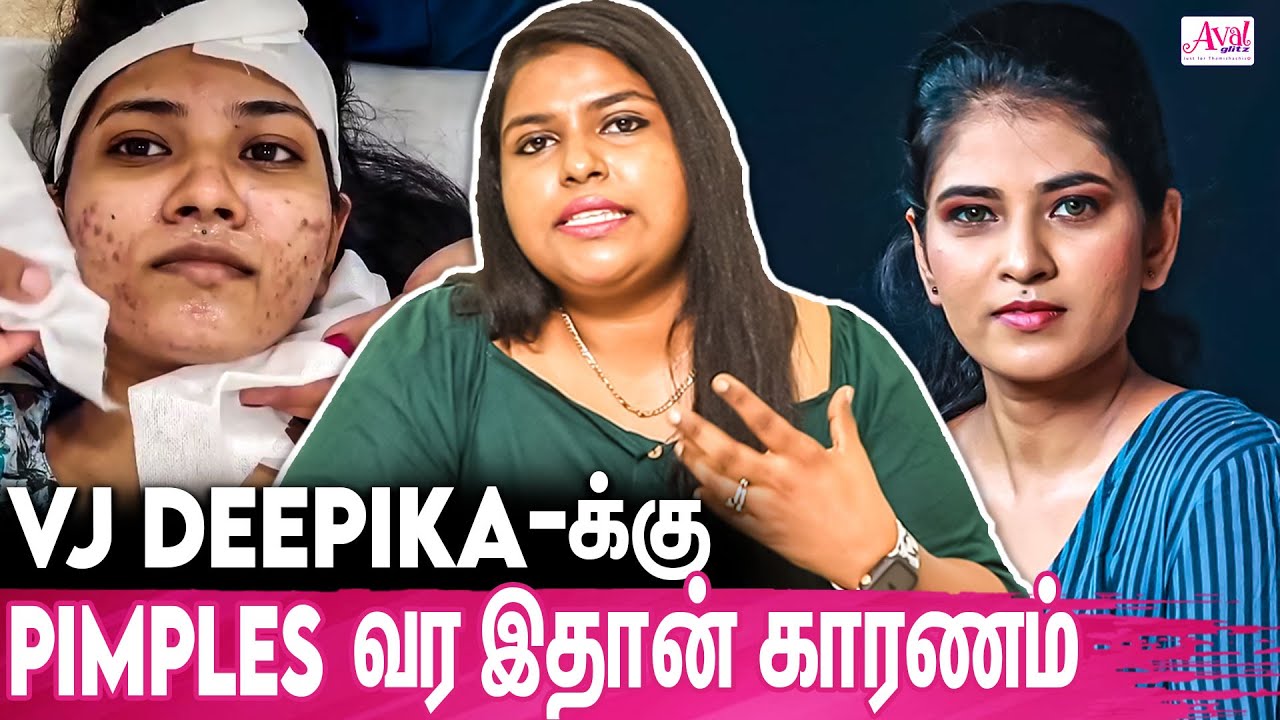Pimples வந்தா இத மட்டும் பண்ணுங்க : Dr Asha Queen About Vj Deepika's Pimples Treatment