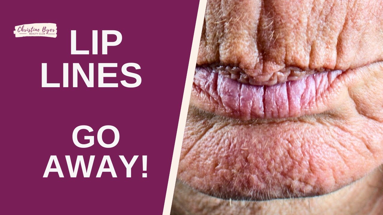 FIX LIP LINES: 8 WAYS TO IMPROVE THEM