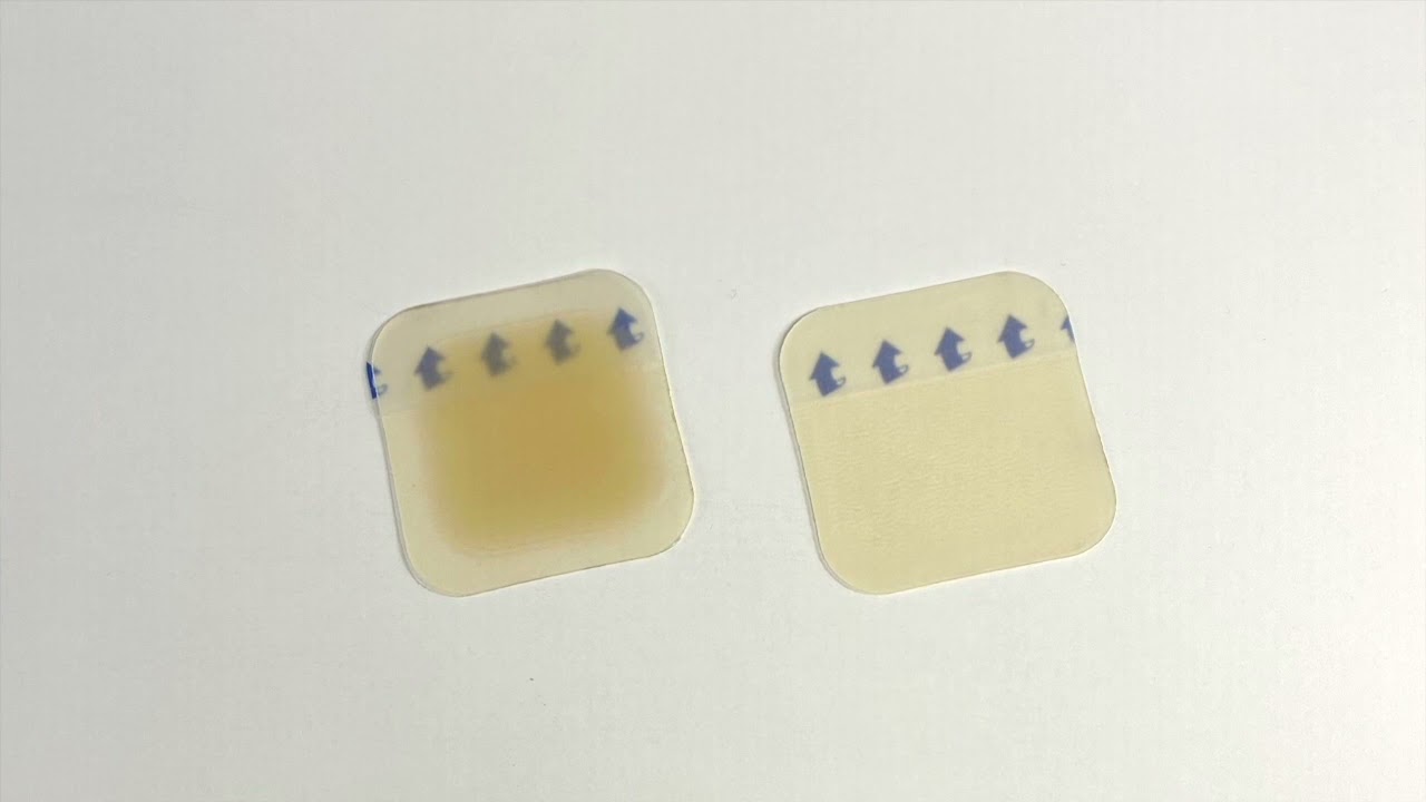 An overview of 9 advanced wound dressings (Part 1)