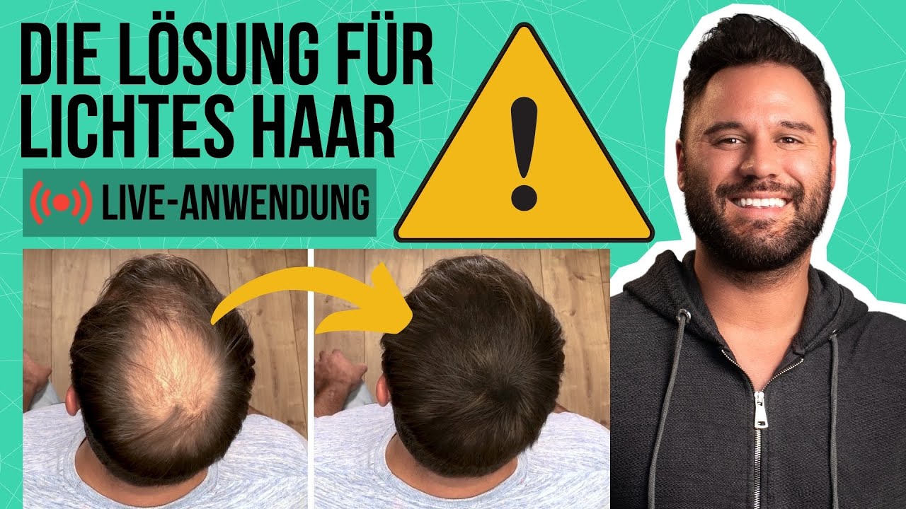 Die Lösung für lichtes Haar (Live Anwendung)