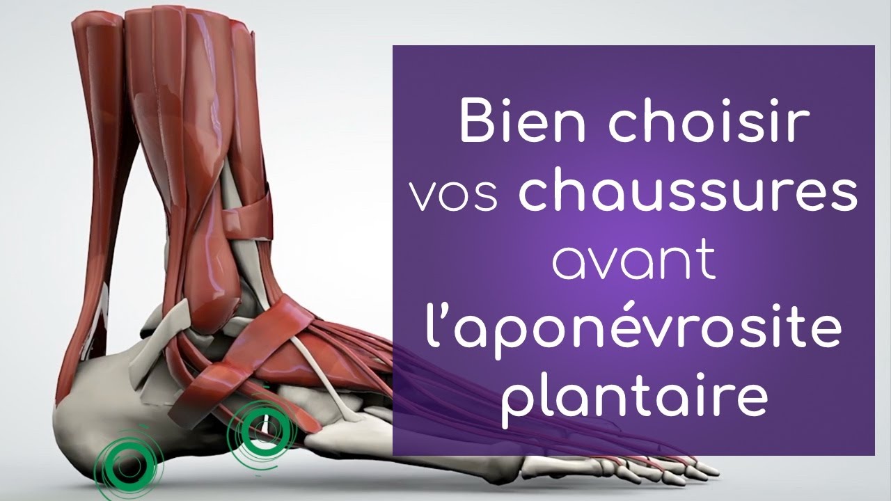 Fasciite plantaire et choix des chaussures  (aponévrosite)