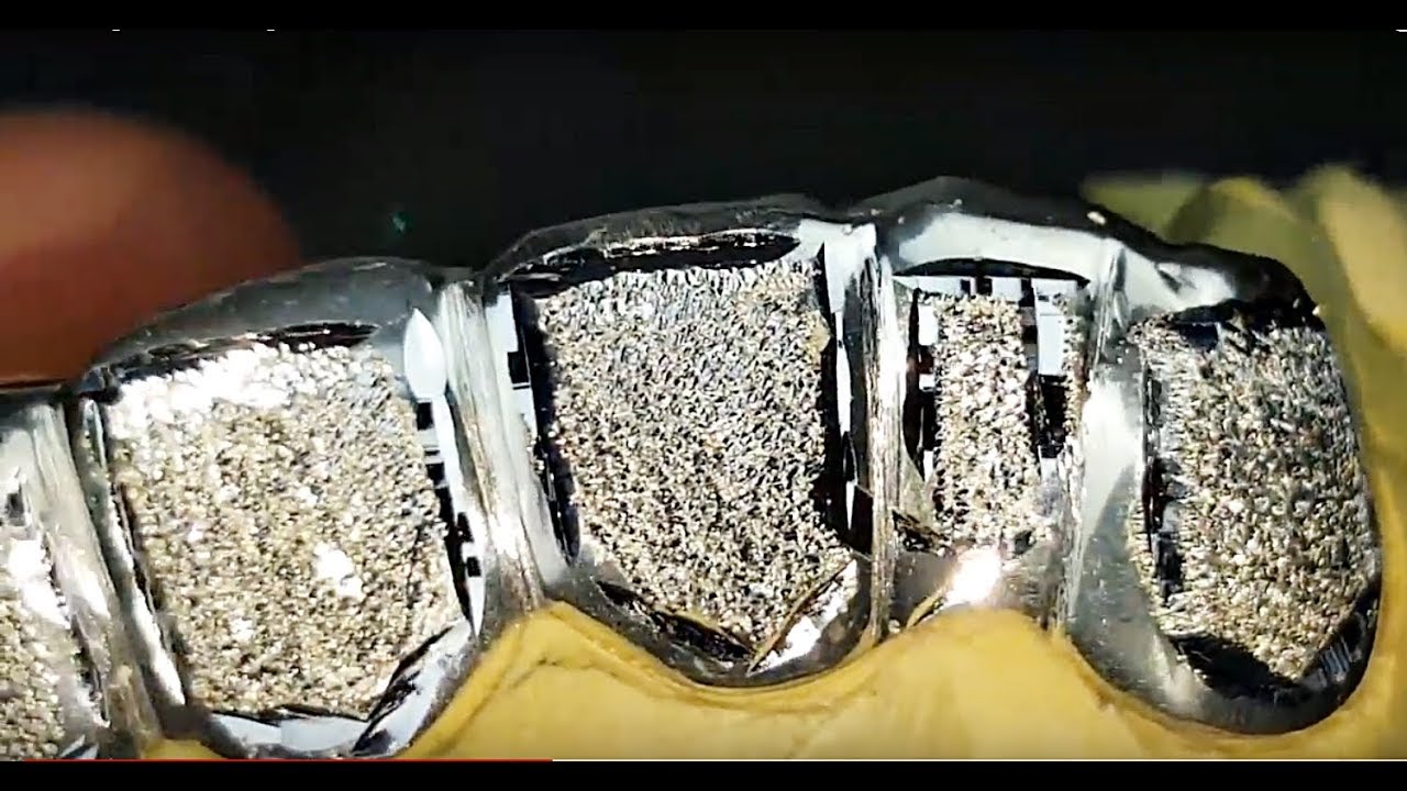 Dazzling 925 Sterling Silver Custom Grillz Diamond Dust Real Teeth Grills!
