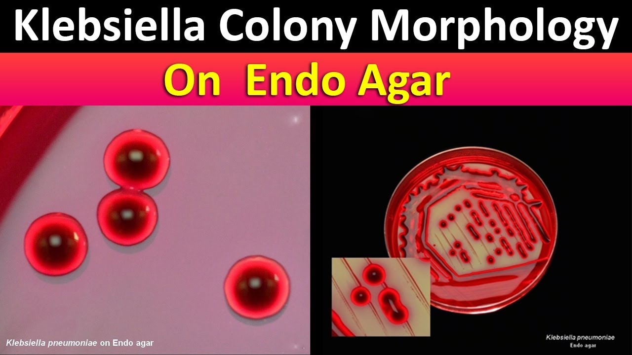 Klebsialla  Colony Morphology On Endo Agar