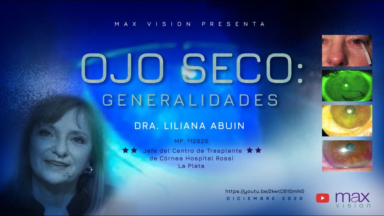 Ojo Seco – Generalidades