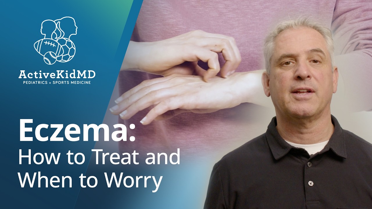 Eczema: How to Treat and When to Worry