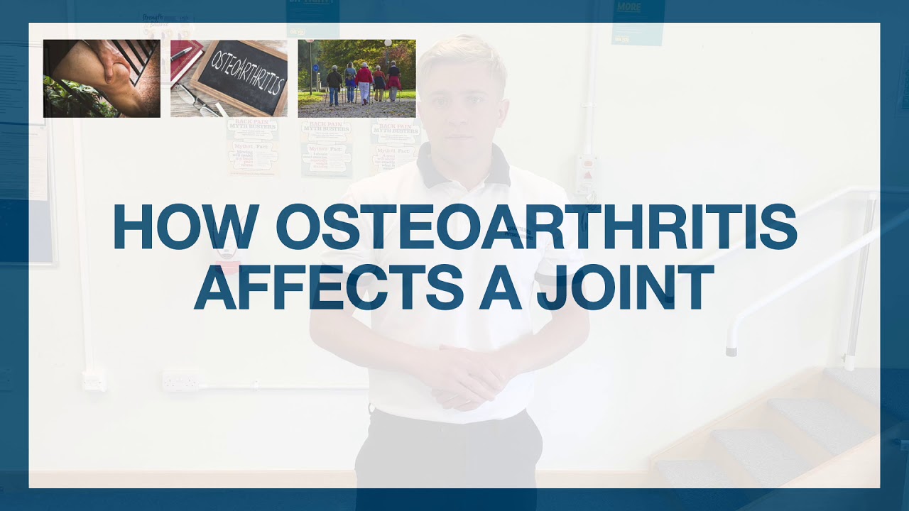 Part One: Understanding Osteoarthritis- MSK Physiotherapy