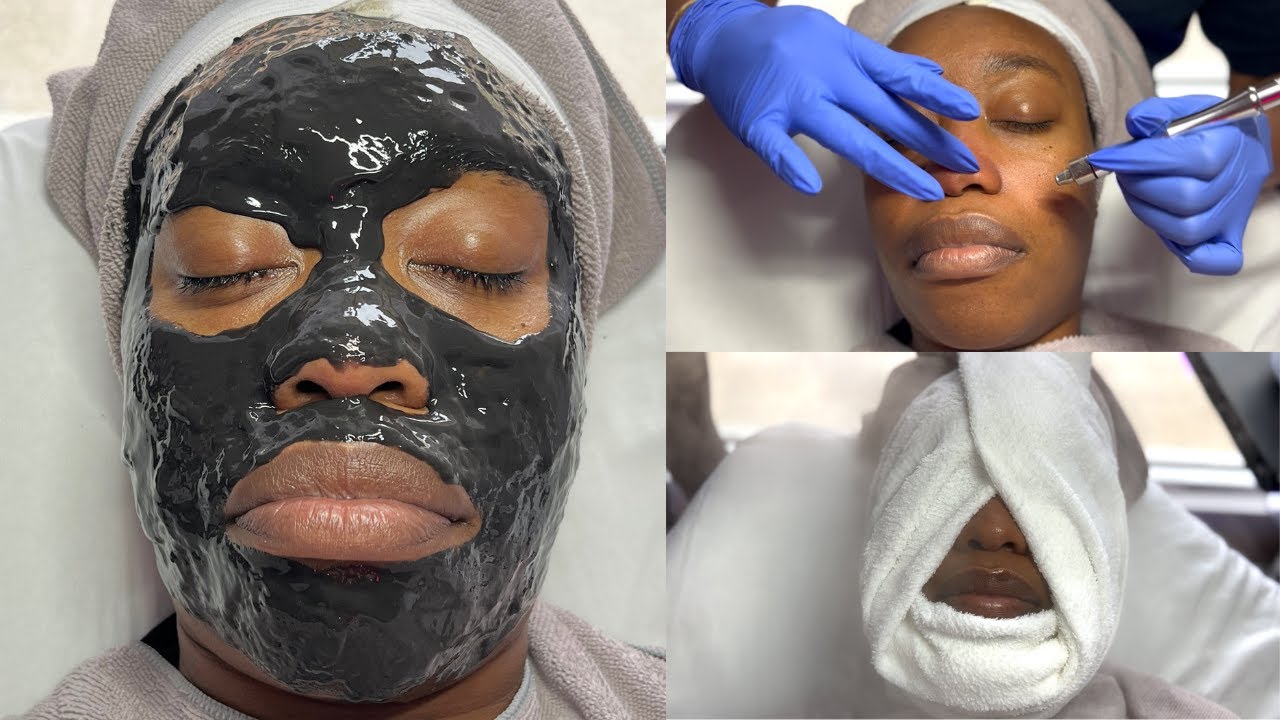 Microderm Winter Glow + Hydration Treatment