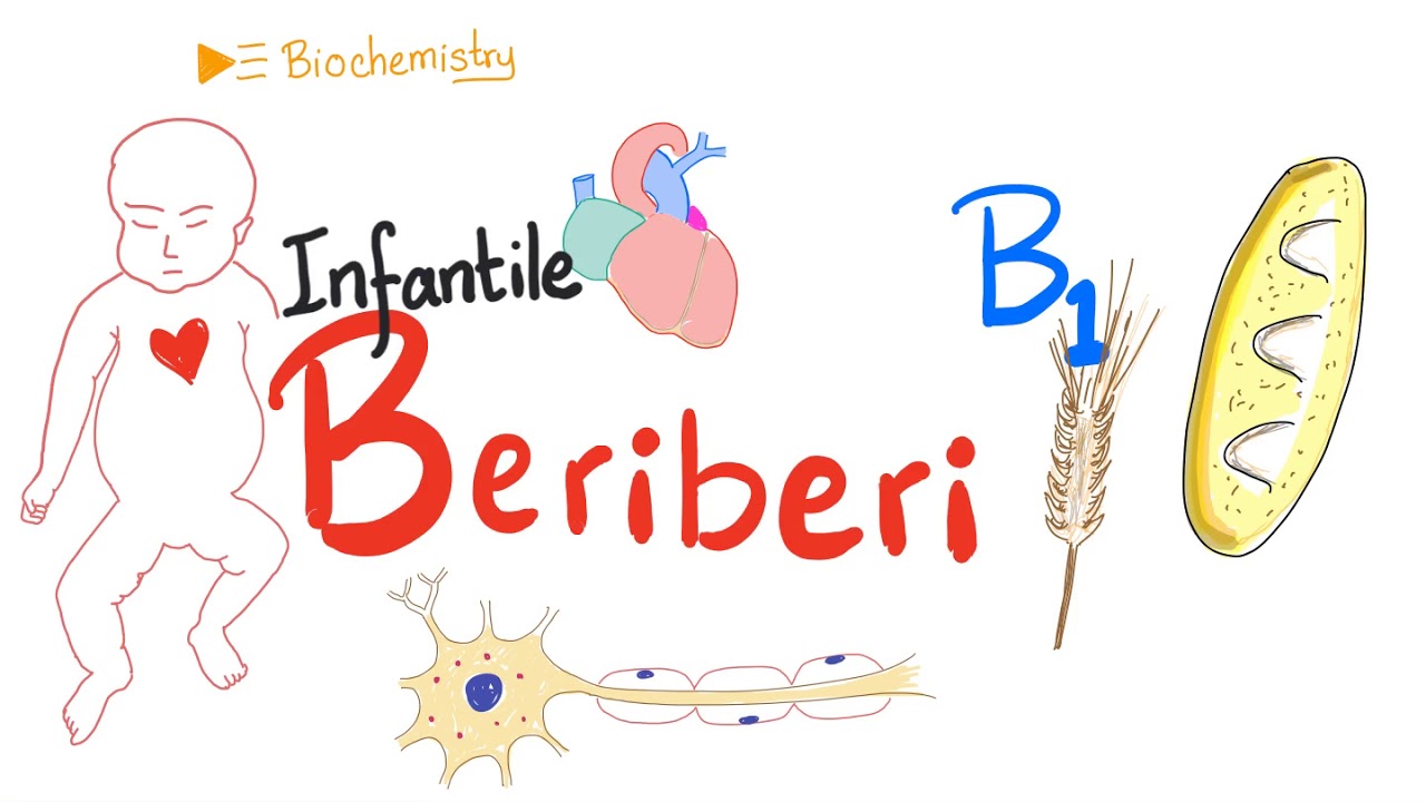 Infantile Beriberi - Vitamin B1 Deficiency - Thiamine Deficiency