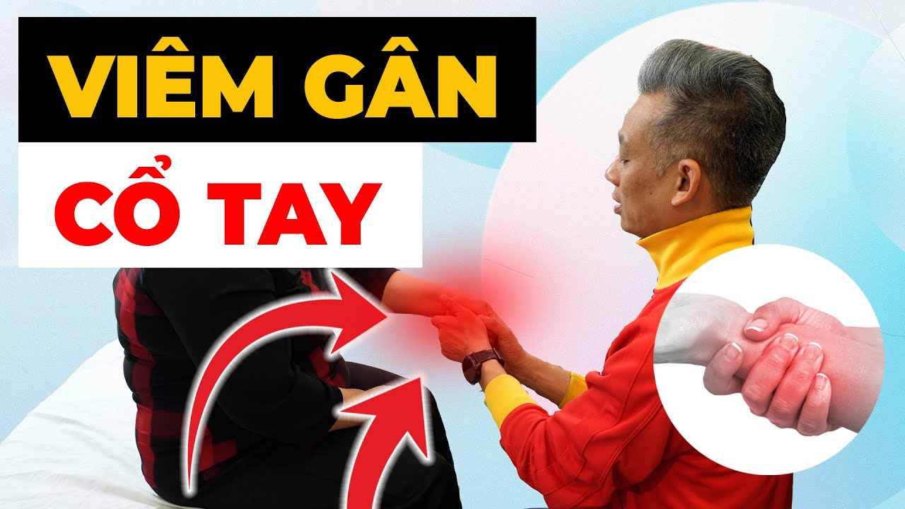 Viêm Gân Cổ Tay Đang ÂM THẦM HỦY HOẠI Cuộc Sống  - GIẢI PHÁP KHẨN CẤP! | Y học Thể thao Starsmec