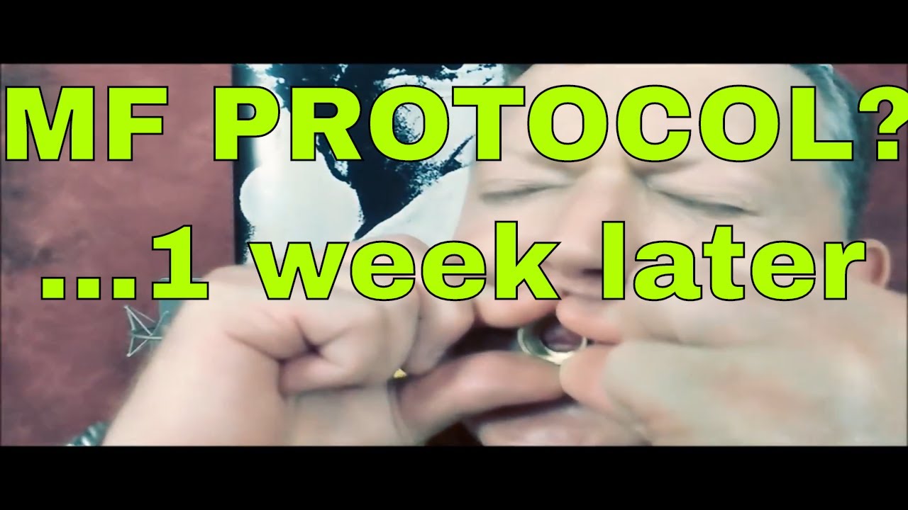 MF MAYNARD FERGUSON LYNN NICHOLSON PROTOCOL UNFURLING ON THE RIM - 1 week later by Kurt Thompson