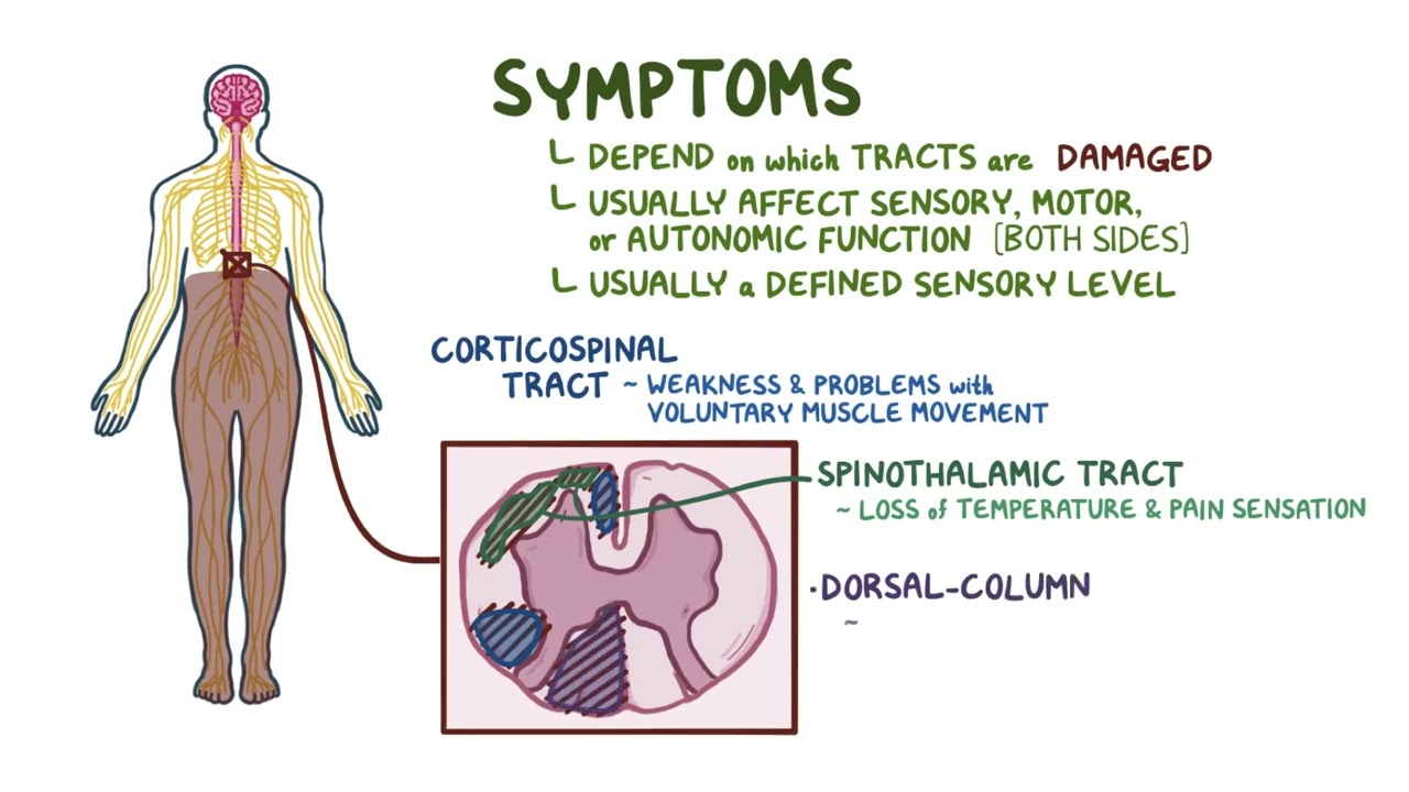 Transverse Myelitis | Osmosis