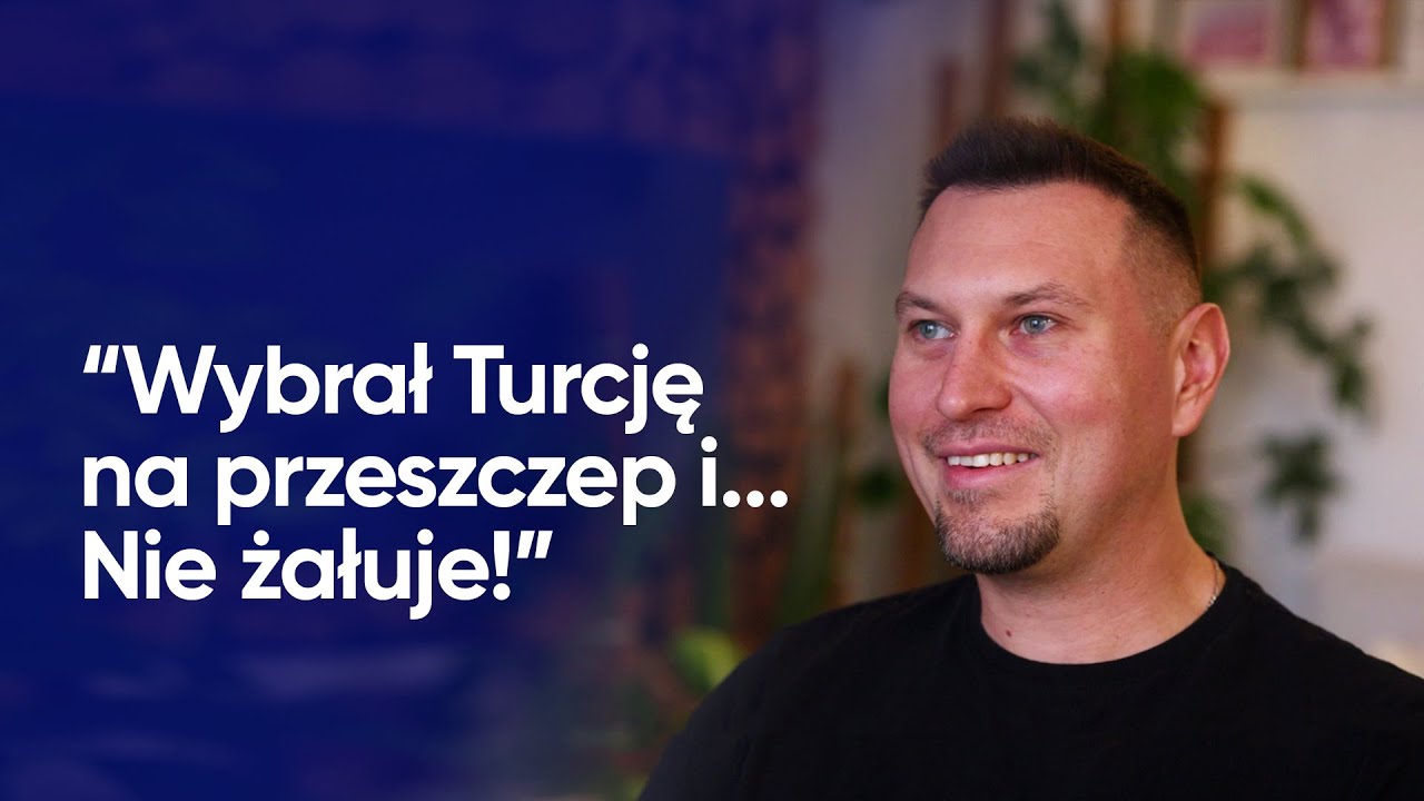 Historia Pawła i jego przeszczepu włosów | Cosmedica Clinic dr. Acar