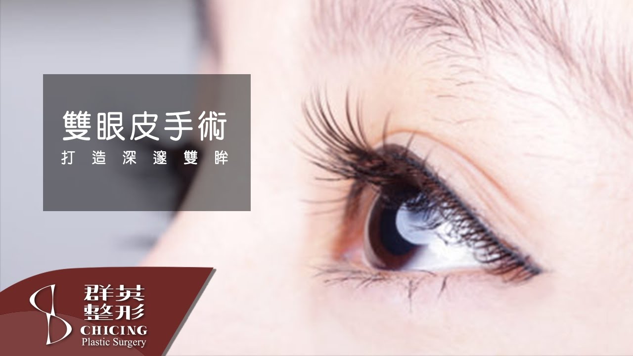 雙眼皮整形 │姚勝發醫師│【群英整形】