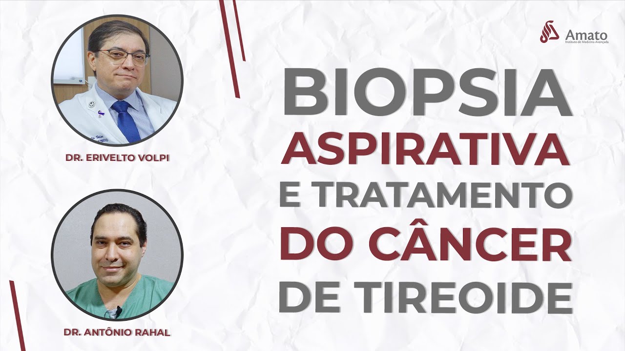 Biopsia Aspirativa por Agulha Fina e Tratamento de C&acirc;ncer de Tireoide com Abla&ccedil;&atilde;o