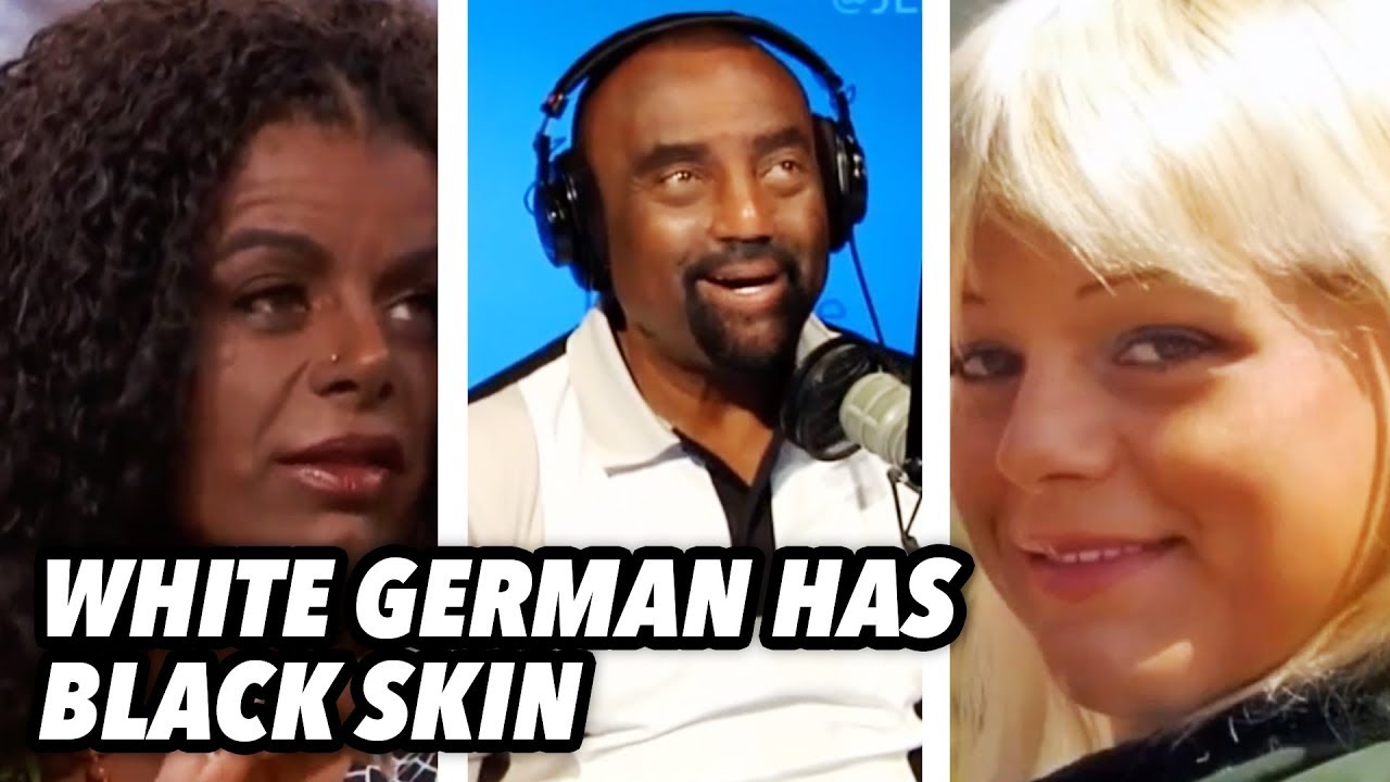 Black Woman's White Skin is HISTORY!
