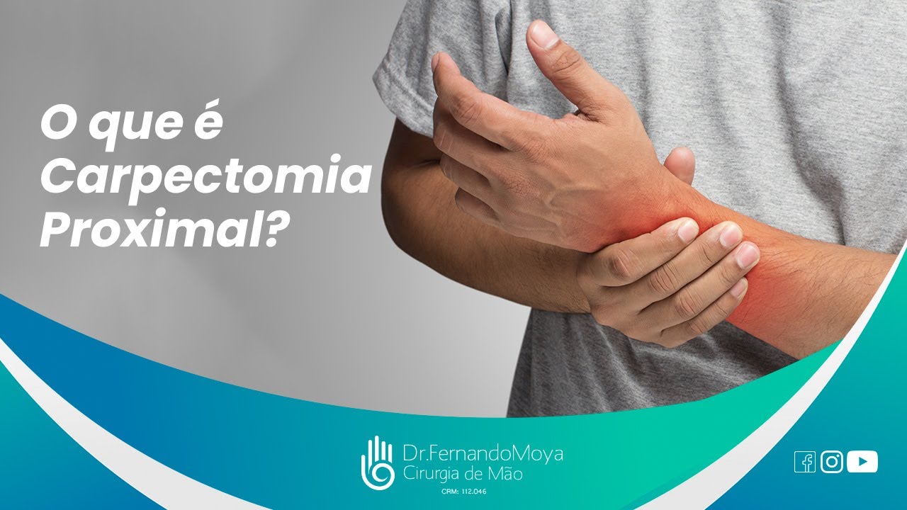 O que é Carpectomia Proximal? | Dr. Fernando Moya CRM 112046