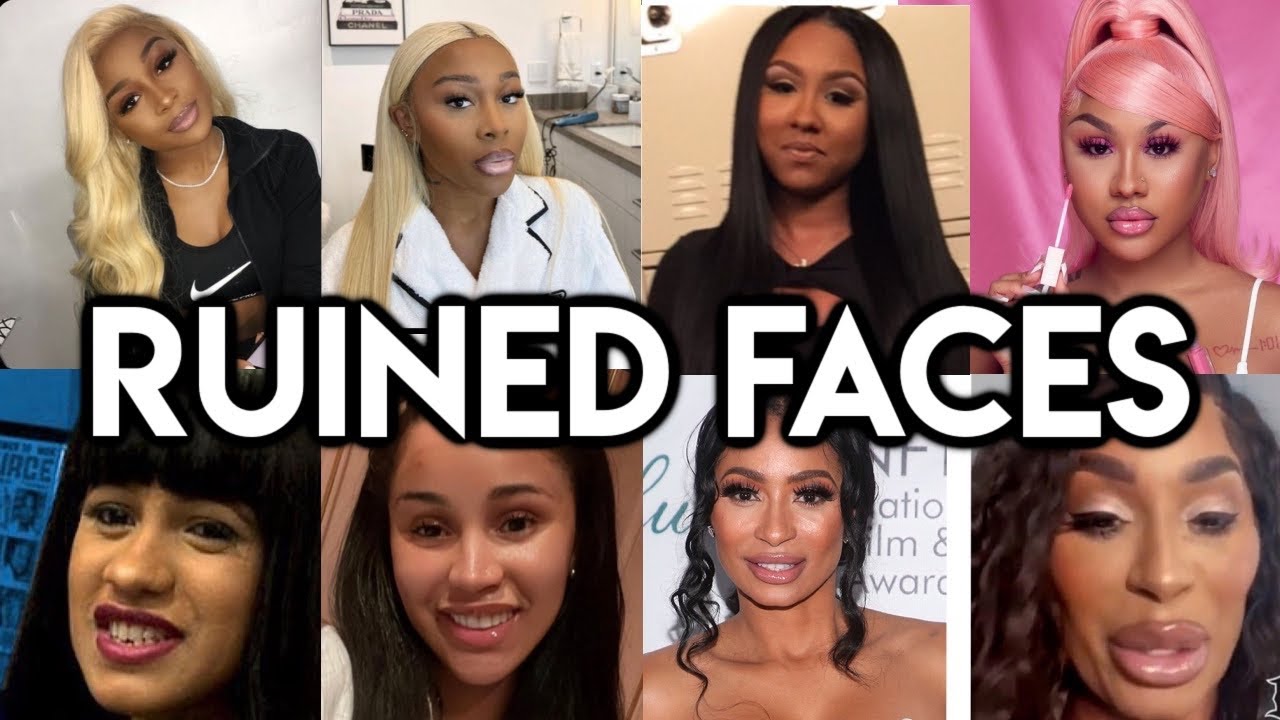 THEY RUINED THEIR FACE 