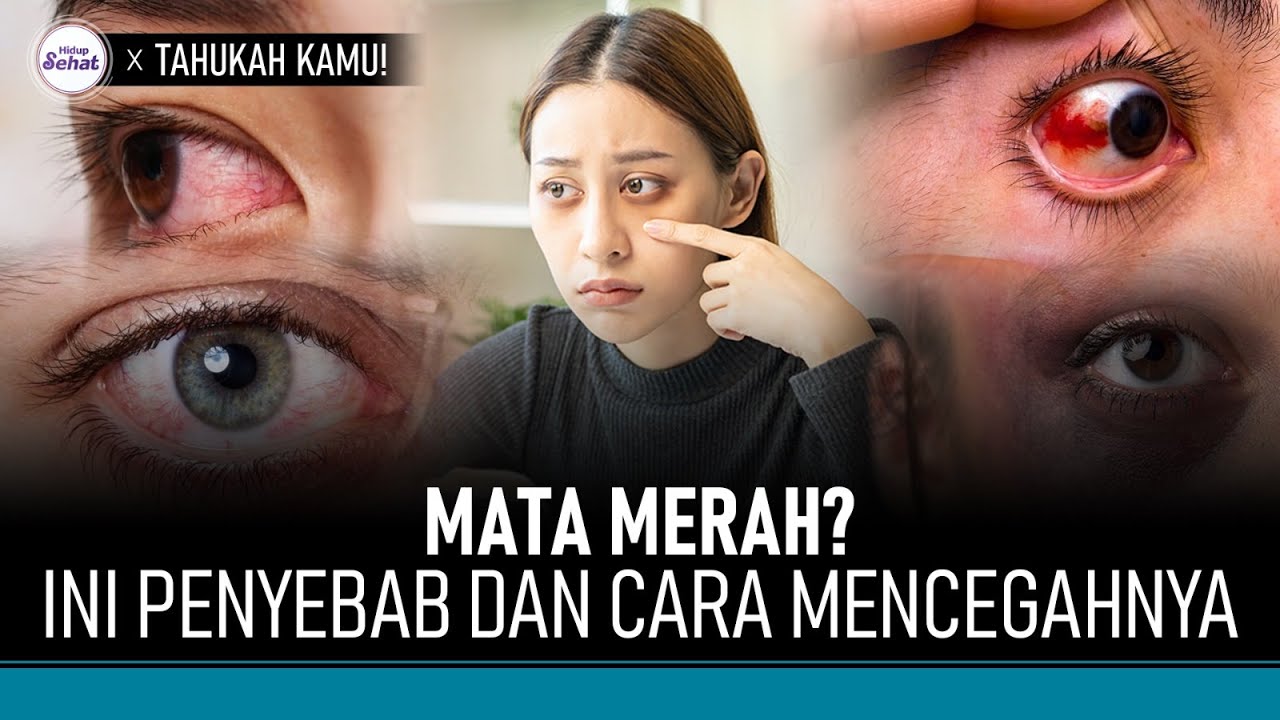 4 Penyebab Mata Merah dan Cara Mencegahnya | Hidup Sehat tvOne