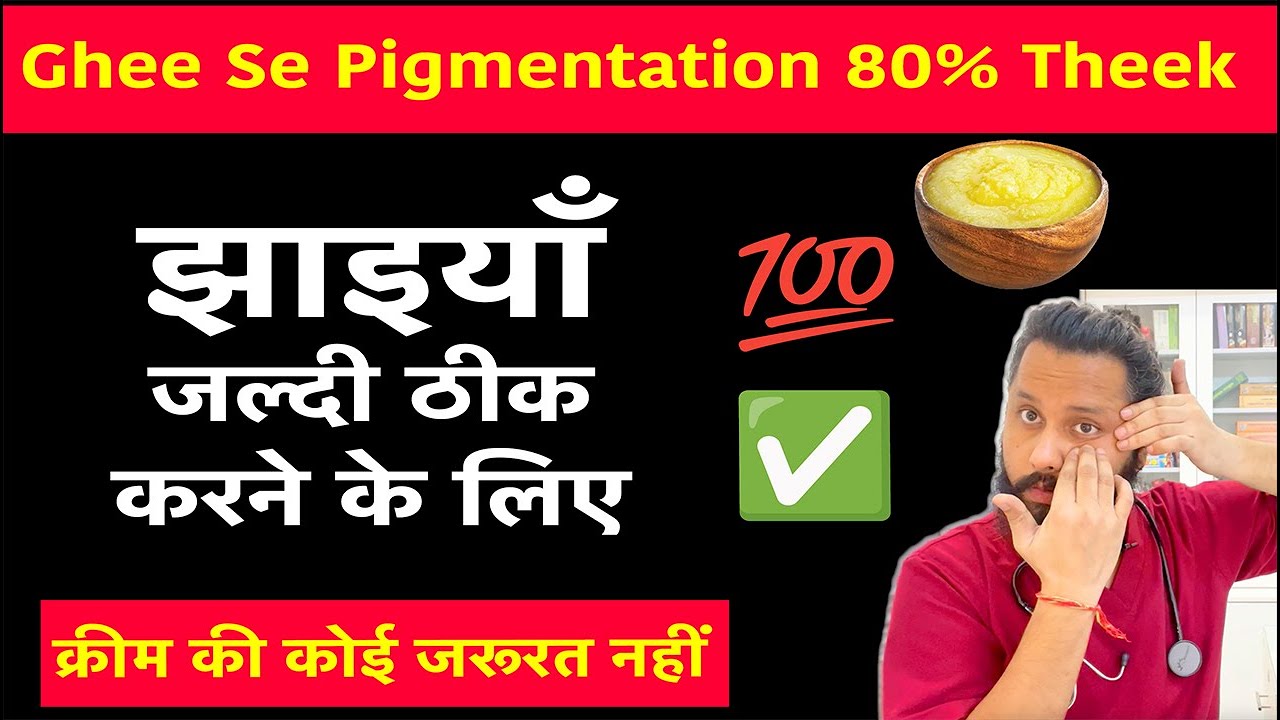 Pigmentation Jladi theek karne ke liye - Dr Prateek chauhan