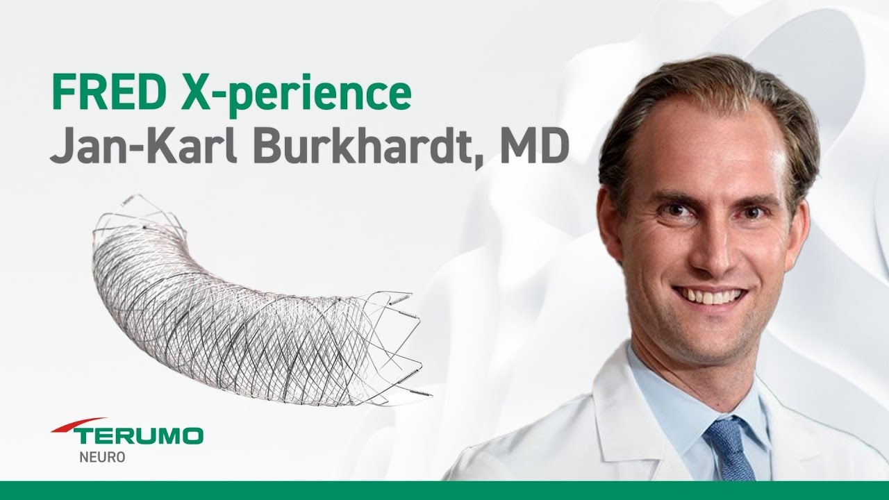 FRED X Flow Diverter Review after 18 Cases &mdash; Honest Outcomes