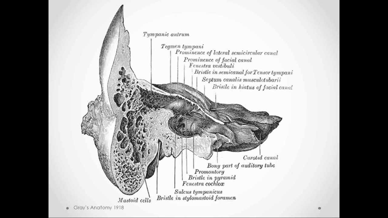 Mastoiditis - USMLE Step 2 Review