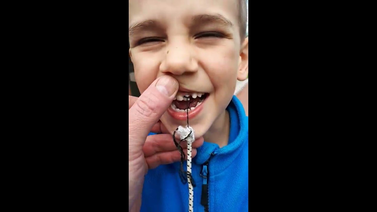 Ctyrkolka a trhani zubu 😂