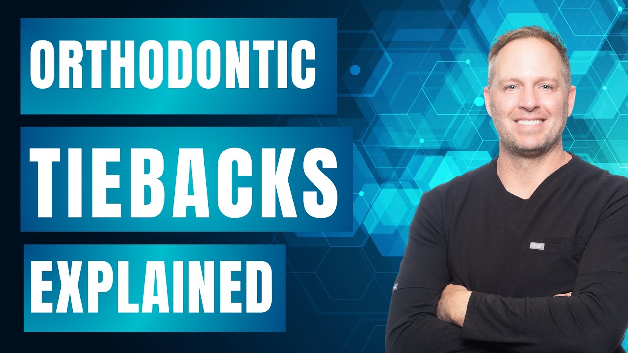 Why We Use Damon Tieback Modules: Simple, Hygienic & Effective! | Ortho Product Highlight