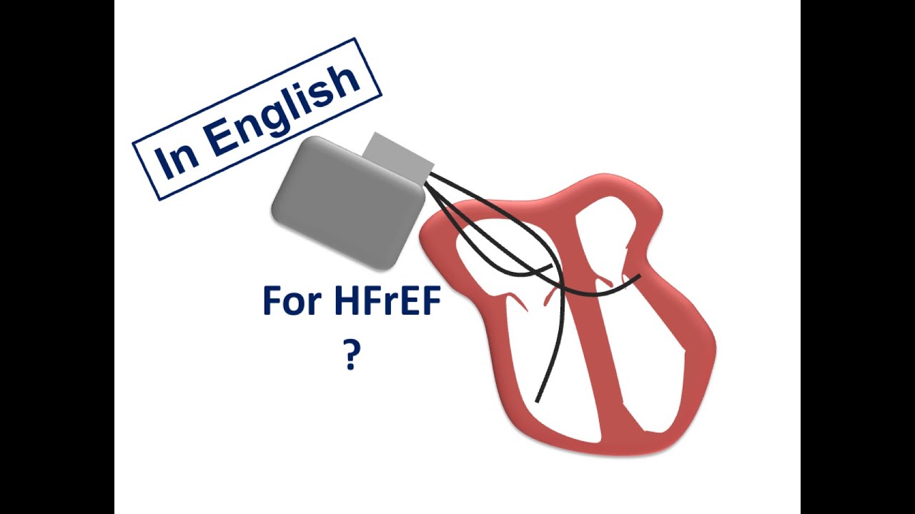 ESC Guidelines: CRT for HFrEF (English Version)