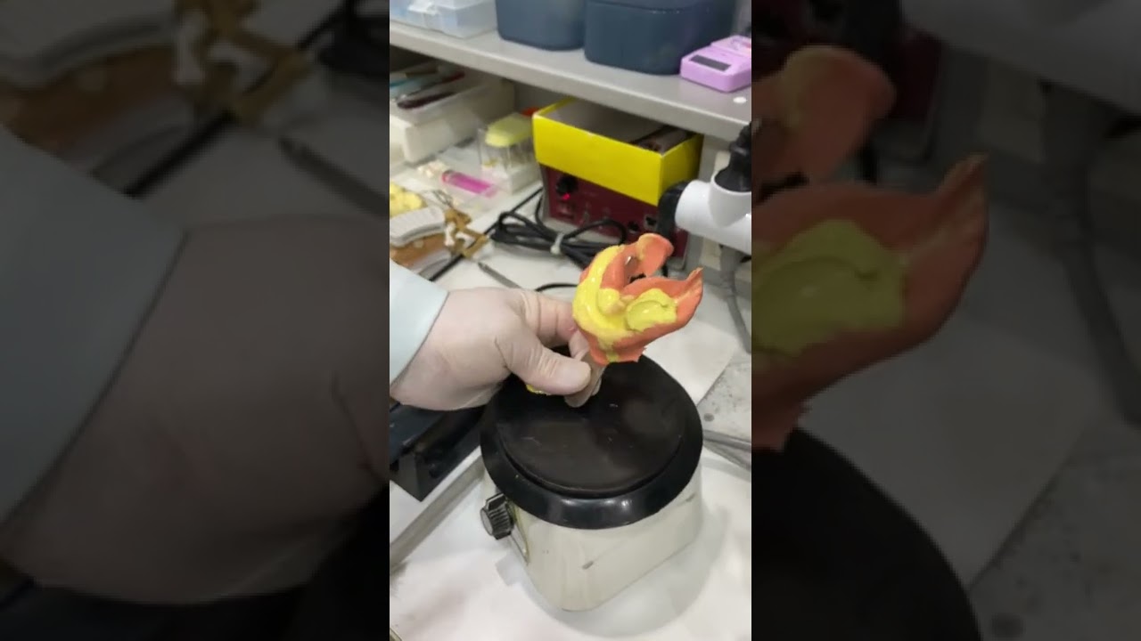 Pouring yellow stone on alginate impression using vacuum mixer