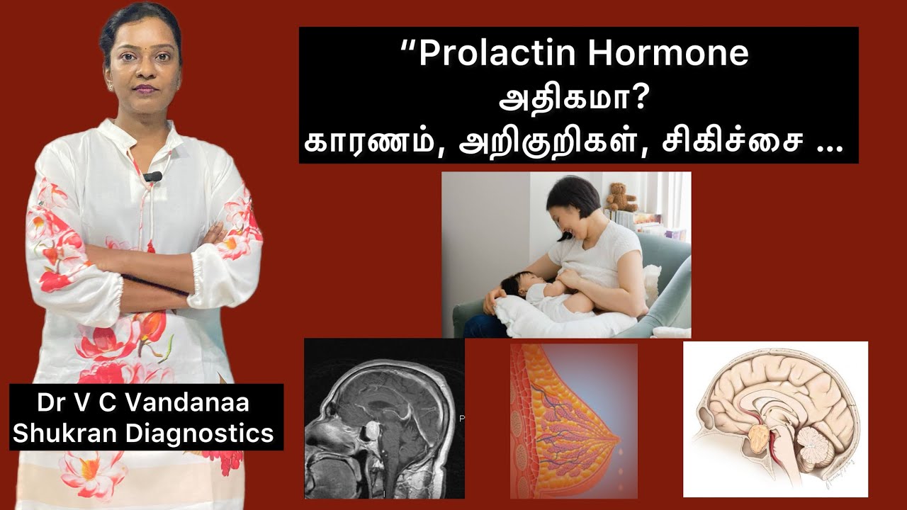 “Prolactin Hormone அதிகமா? காரணம், அறிகுறிகள், சிகிச்சை… #prolactin #infertility #drvandanaa