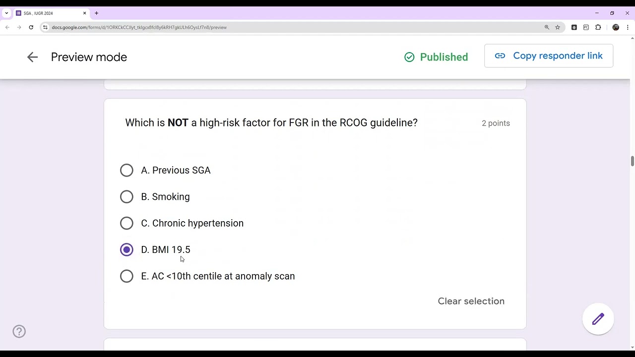SGA mock 1 exam on recent updates 2025 MRCOG part 2