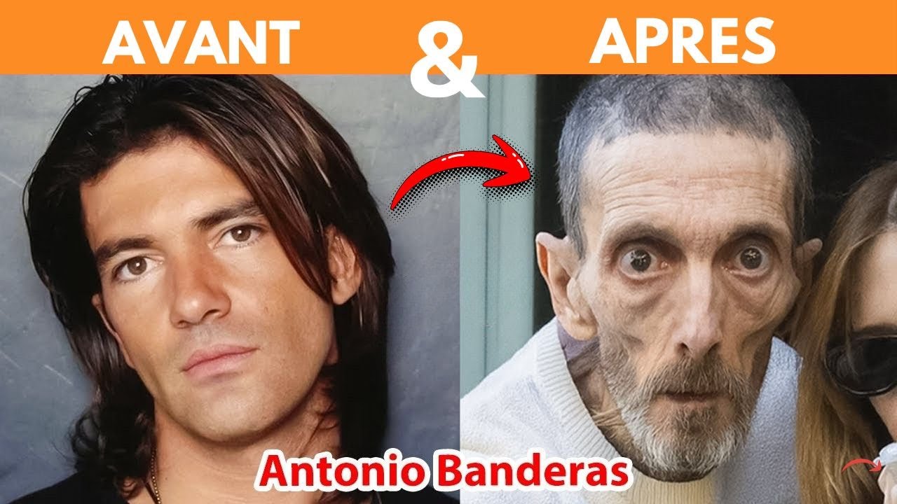 Vous Ne Reconnaîtrez Plus Ces Célèbres Stars!