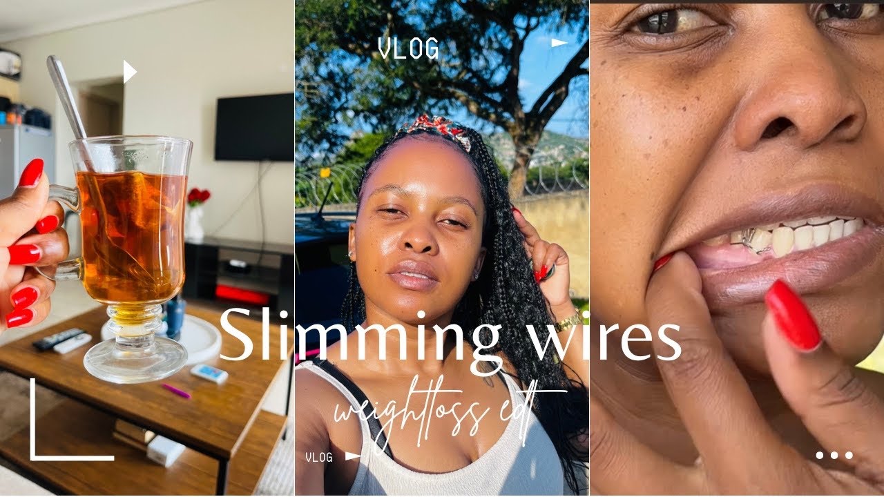 Wired my Jaw for weight loss || liquid diet only for three weeks. No chewing 😒