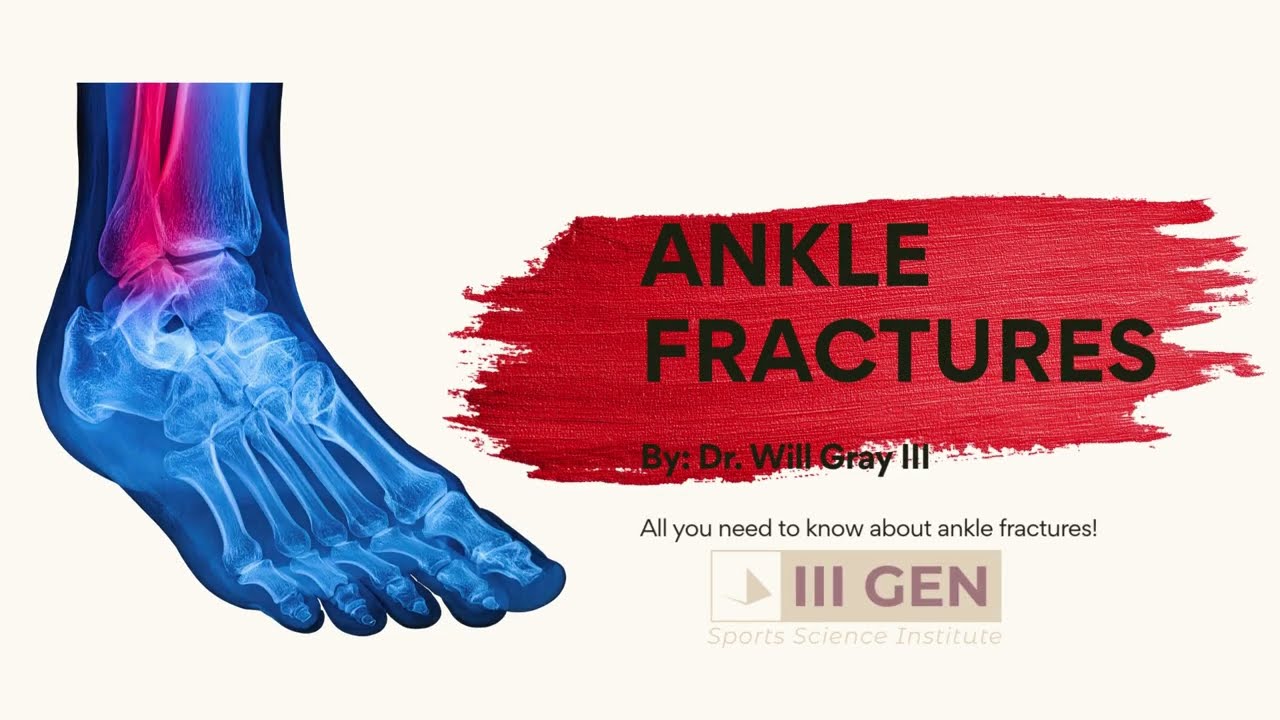 Ankle Fractures: Signs & Symptoms, Diagnosis, Treatment Options, Rehabilitation, and more