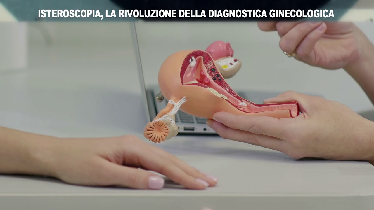 ISTEROSCOPIA, LA RIVOLUZIONE DELLA DIAGNOSTICA GINECOLOGICA - REDAZIONALE