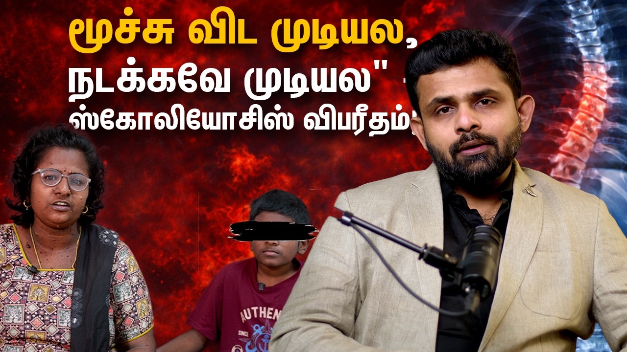 மூச்சு விட முடியல நடக்கவே முடியல ஸ்கோலியோசிஸ் விபரீதம் Dr. Vignesh Pushparaj