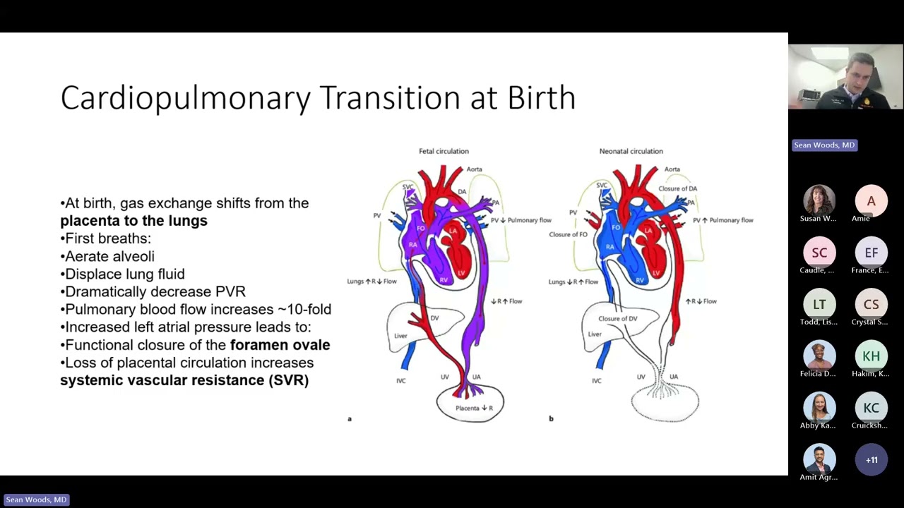 Solara Grand Rounds - Neonatal Transition, Physiology in Motion