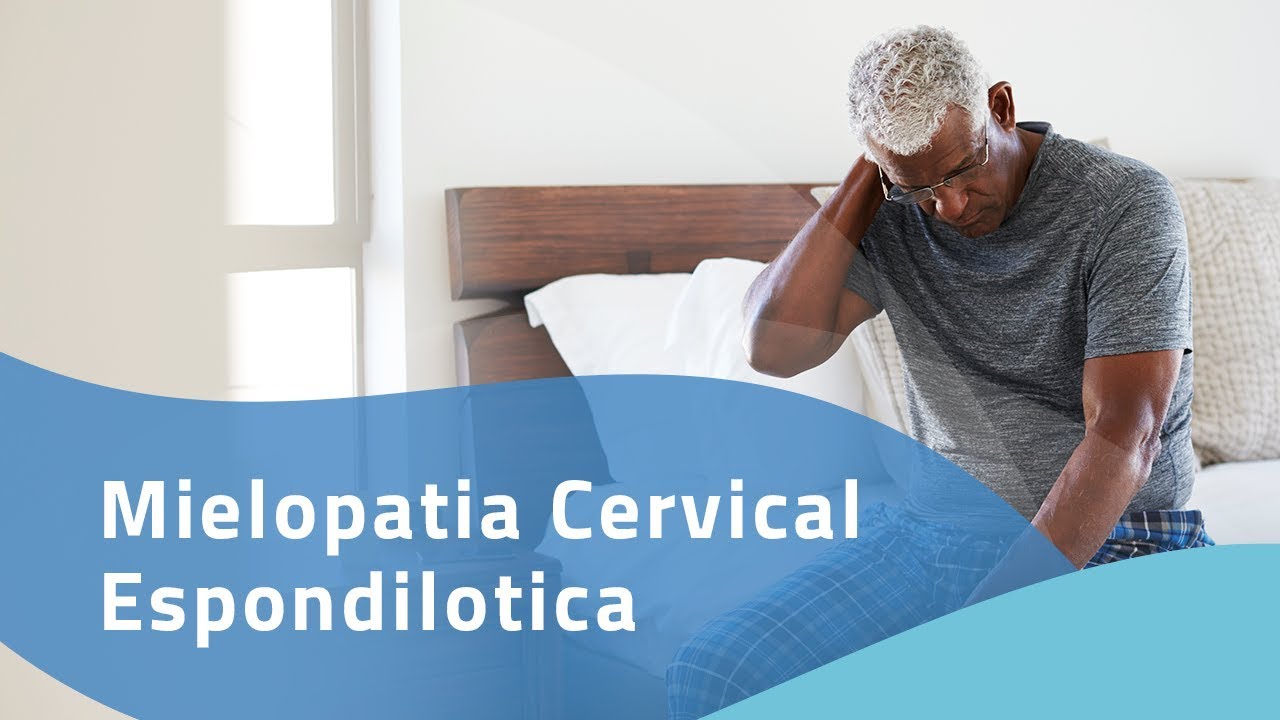 MIELOPATIA CERVICAL DEGENERATIVA